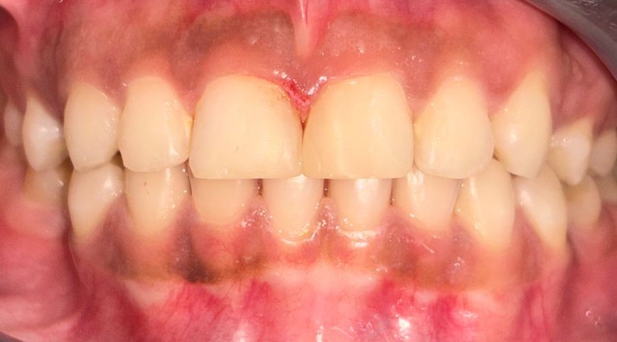 composite-10b