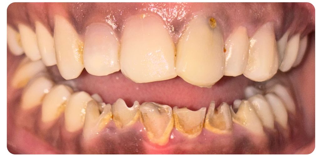 smile-1a