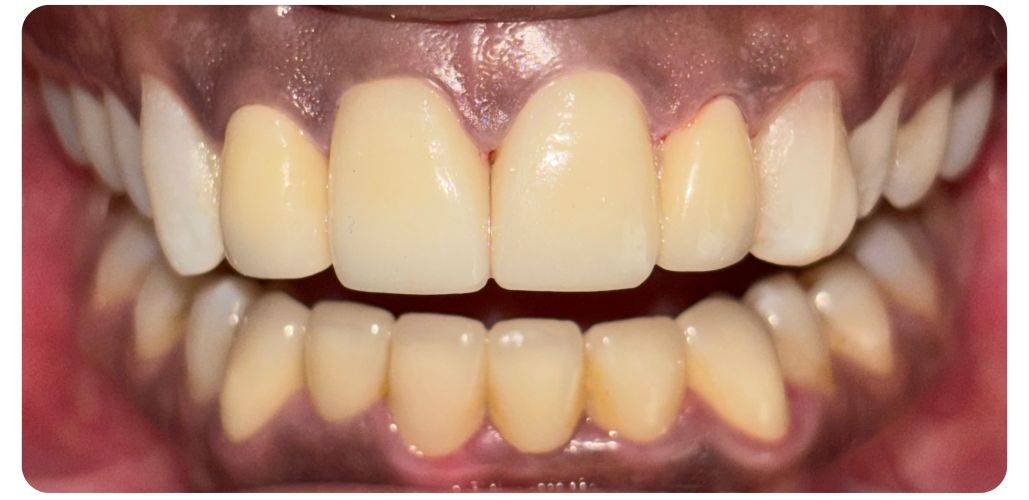 smile-1b
